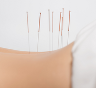 Er din akupunktør uddannet i akupunktur?