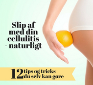 Slip af med din cellulitis - naturligt